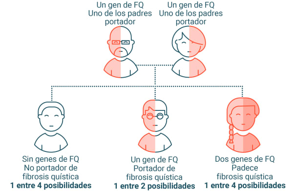 Si 2 padres portadores cada uno de un gen de fibrosis quística tienen 3 hijos, tienen una probabilidad de 1 entre 4 de tener un hijo sin genes de fibrosis quística y que no sea portador de esta enfermedad, una probabilidad de 1 entre 2 de tener un hijo con 1 gen de fibrosis quística y que sea portador de esta enfermedad, y una probabilidad de 1 entre 4 de tener un hijo con 2 genes de fibrosis quística y que padezca la enfermedad.